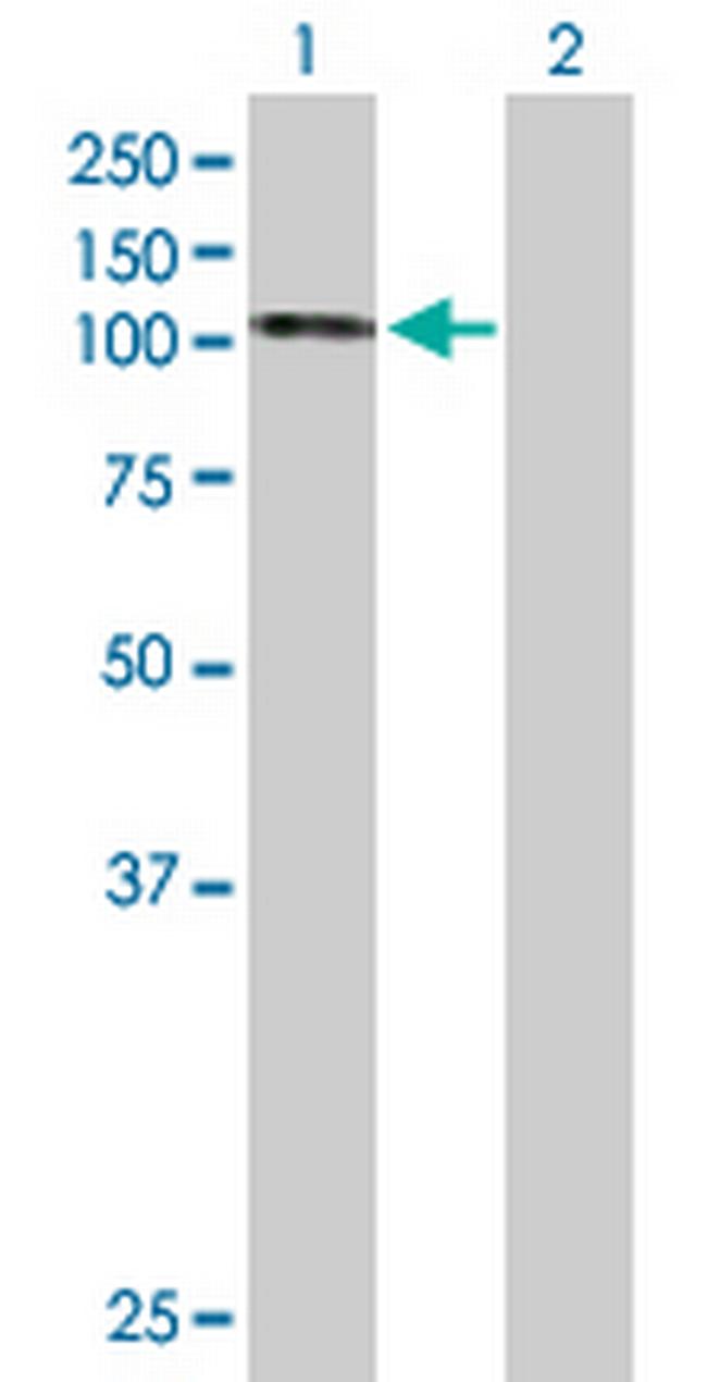 HSPH1 Antibody in Western Blot (WB)