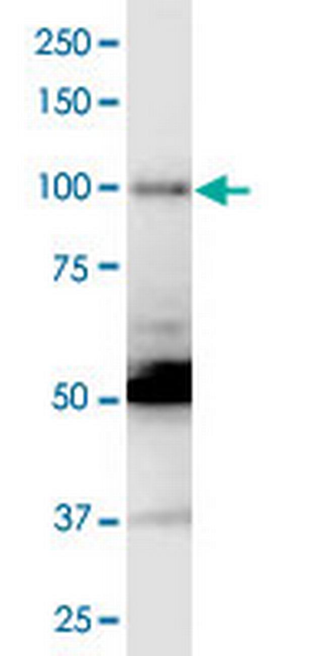 ALDH1L1 Antibody in Western Blot (WB)