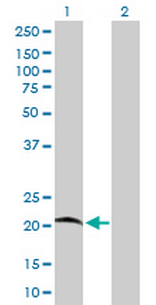 C7orf16 Antibody in Western Blot (WB)