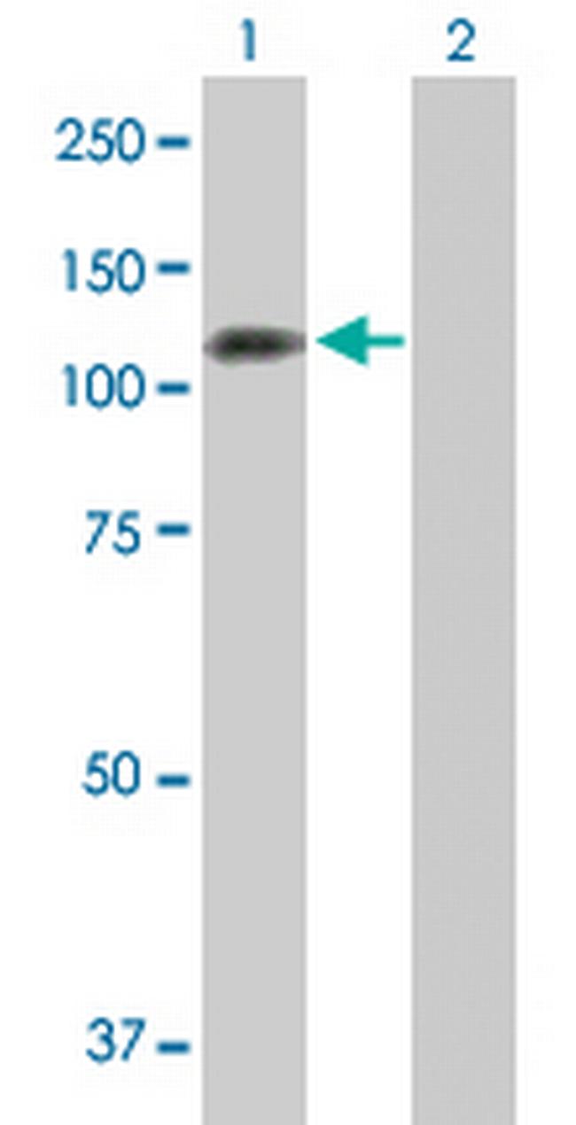 PPP1R13L Antibody in Western Blot (WB)