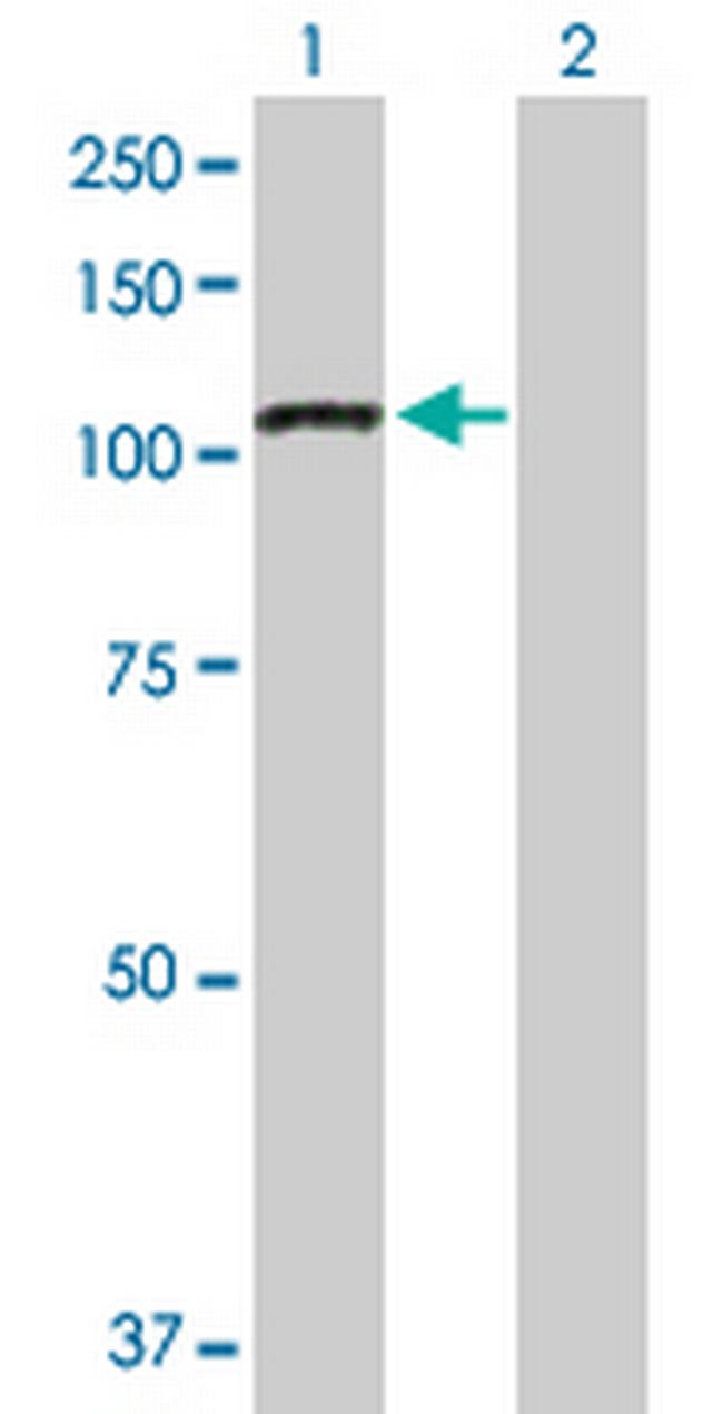 PPP1R13L Antibody in Western Blot (WB)