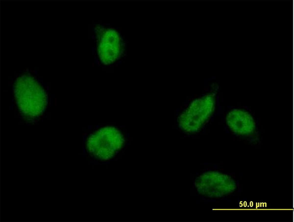 RUVBL2 Antibody in Immunocytochemistry (ICC/IF)