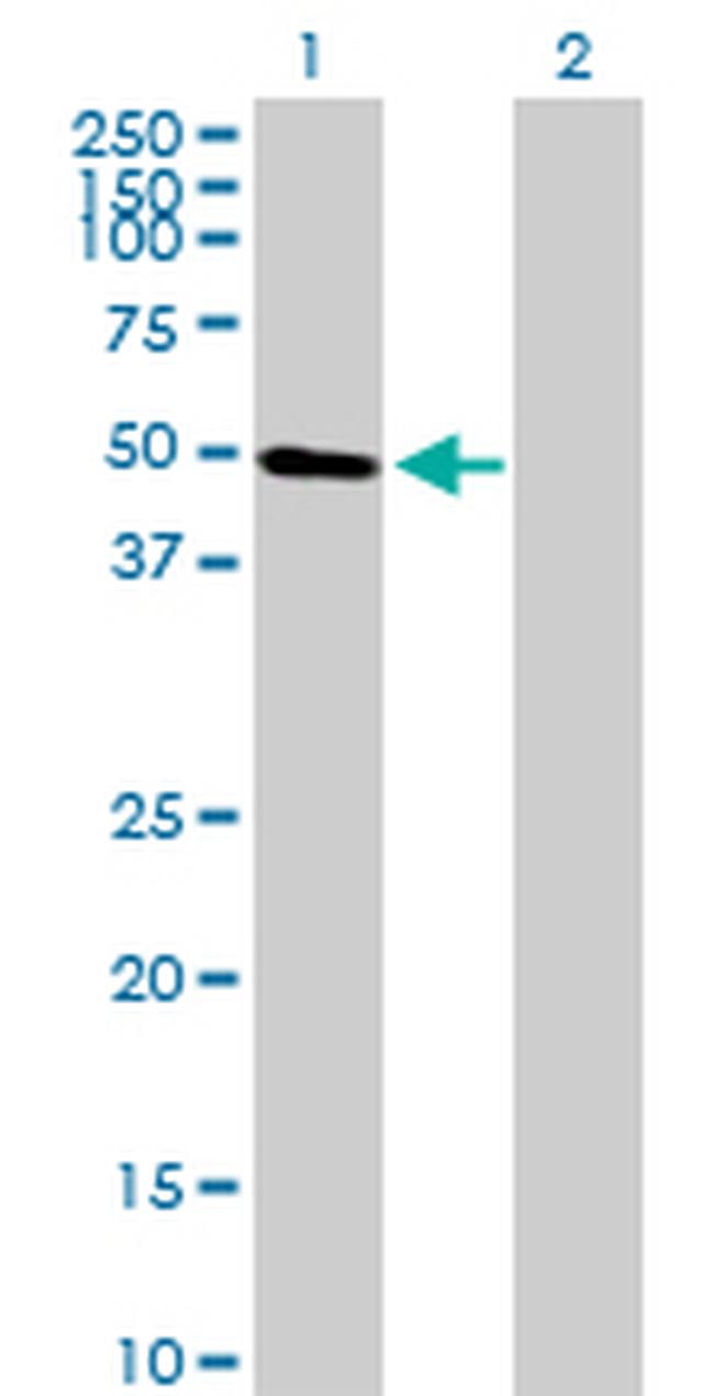 ARID5A Antibody in Western Blot (WB)
