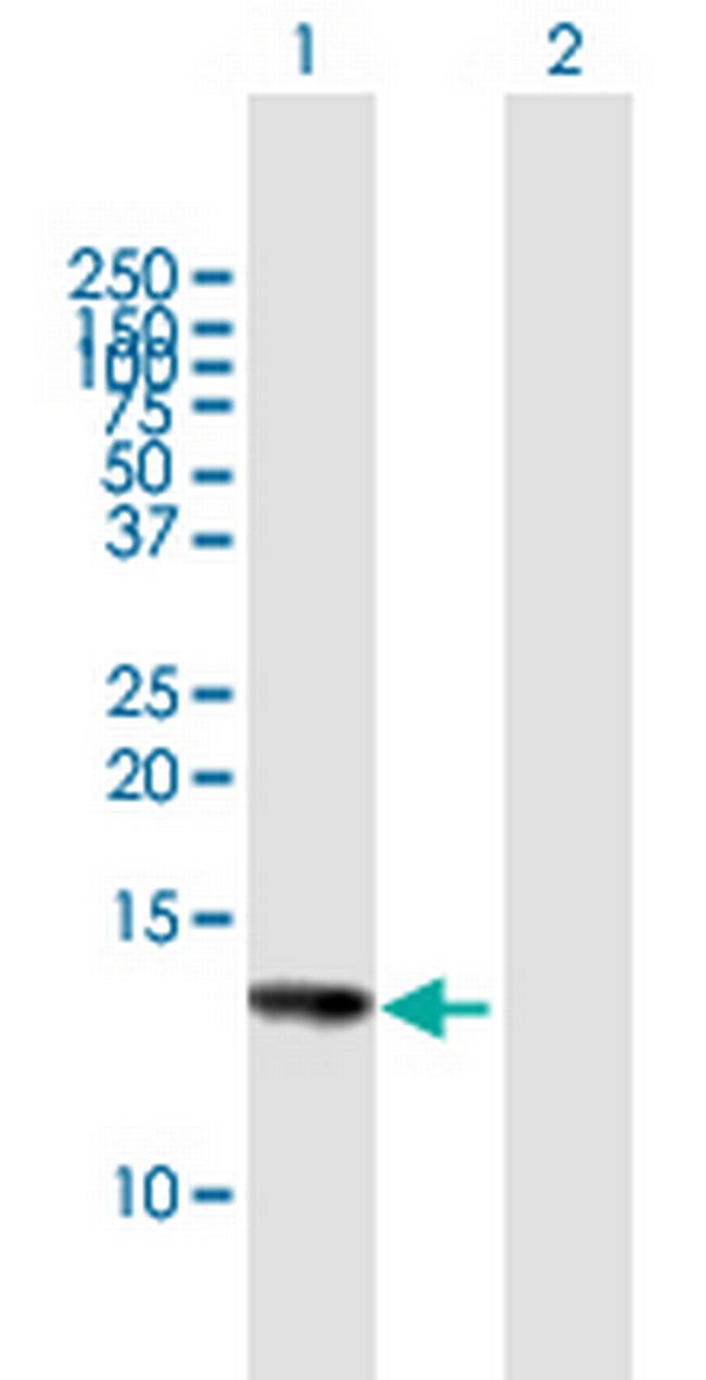 HCP5 Antibody in Western Blot (WB)