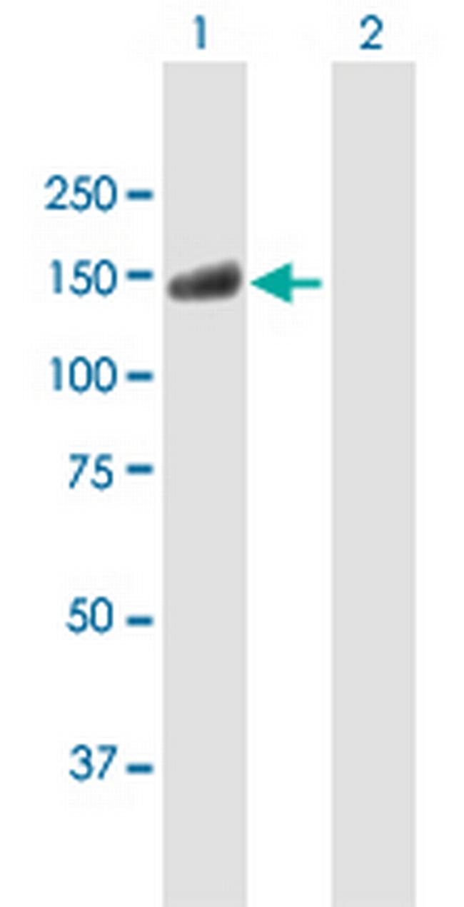 USP20 Antibody in Western Blot (WB)