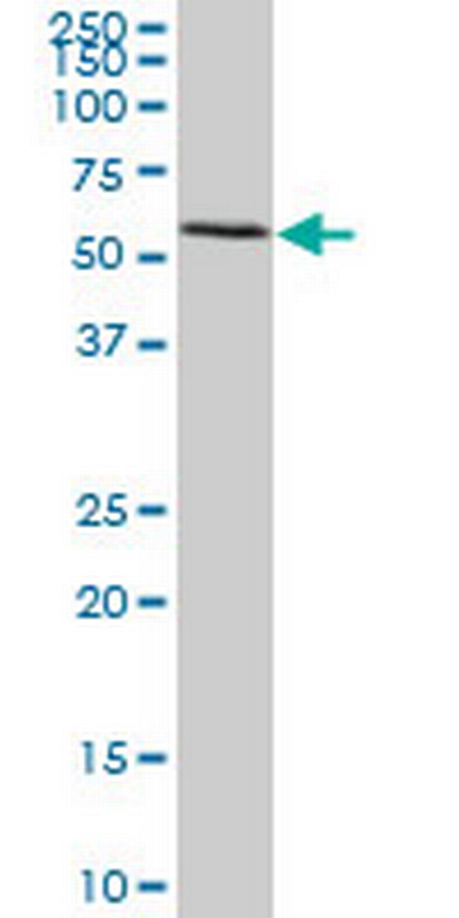 FGL2 Antibody in Western Blot (WB)