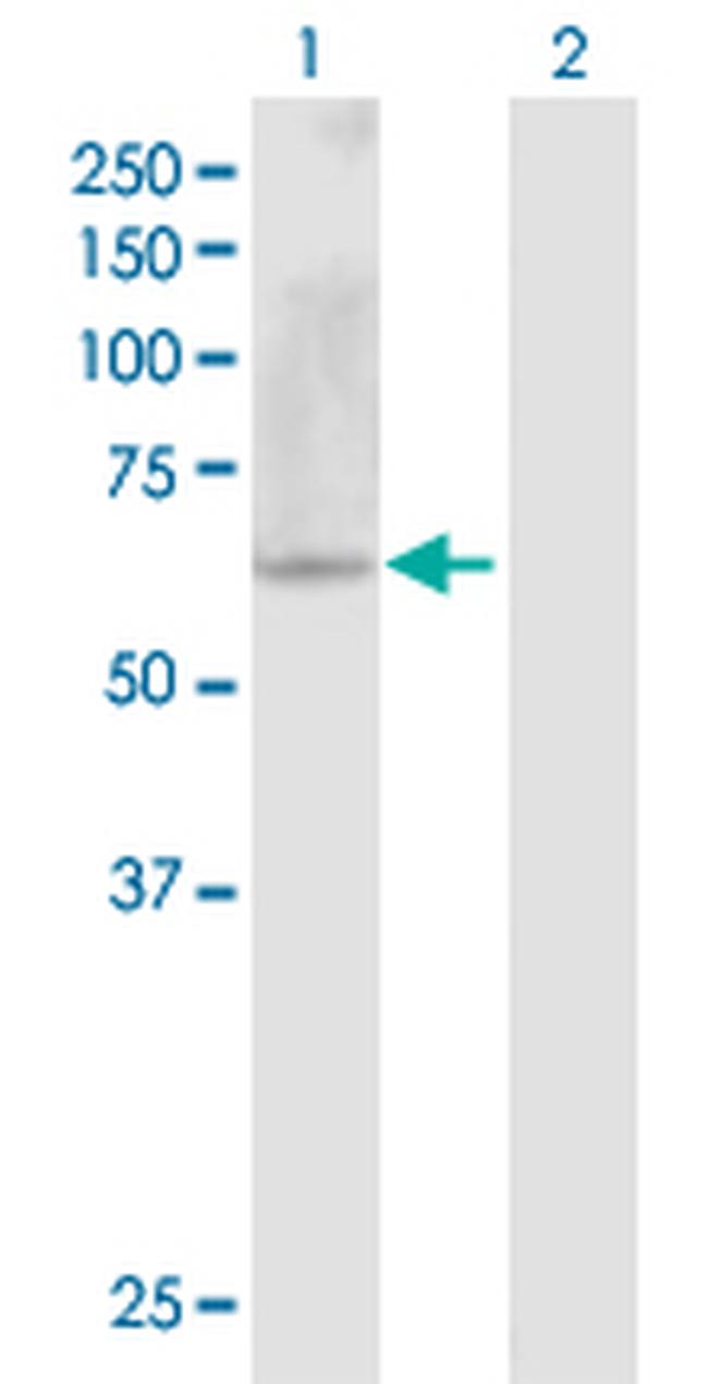 NPFFR2 Antibody in Western Blot (WB)