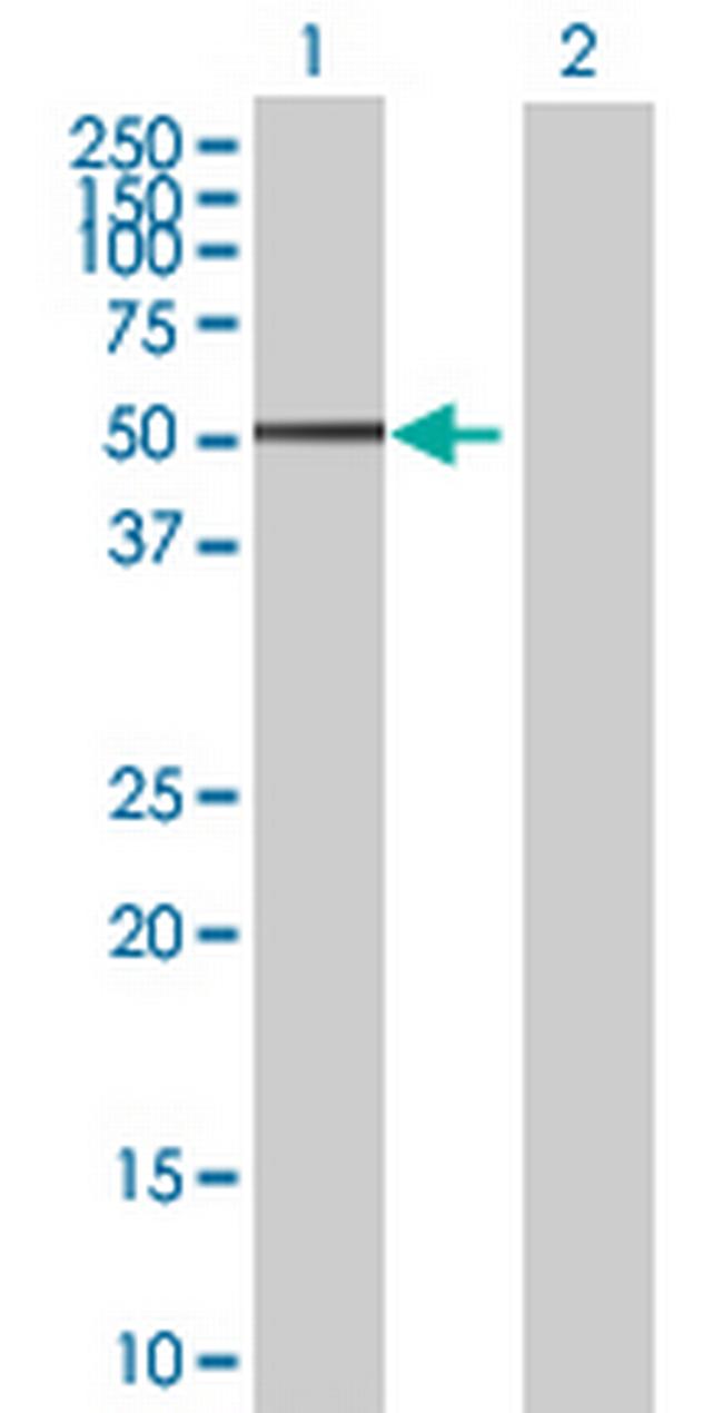 XLKD1 Antibody in Western Blot (WB)