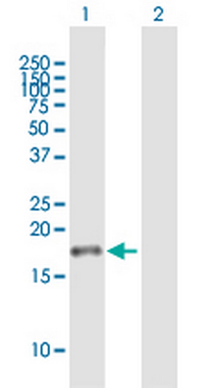 JTB Antibody in Western Blot (WB)
