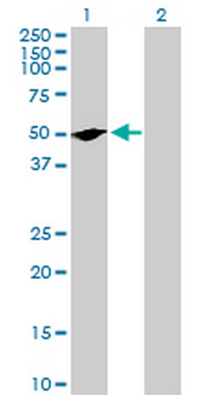 RUNDC3A Antibody in Western Blot (WB)