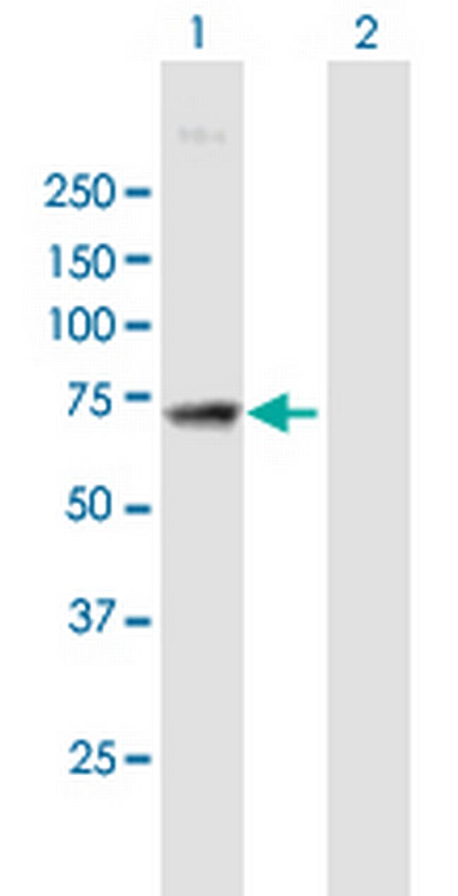 MAN1A2 Antibody in Western Blot (WB)