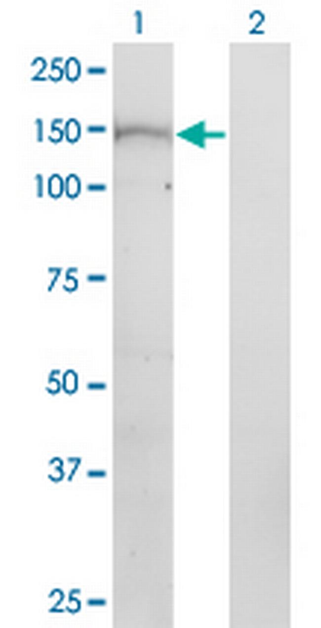 NTE Antibody in Western Blot (WB)