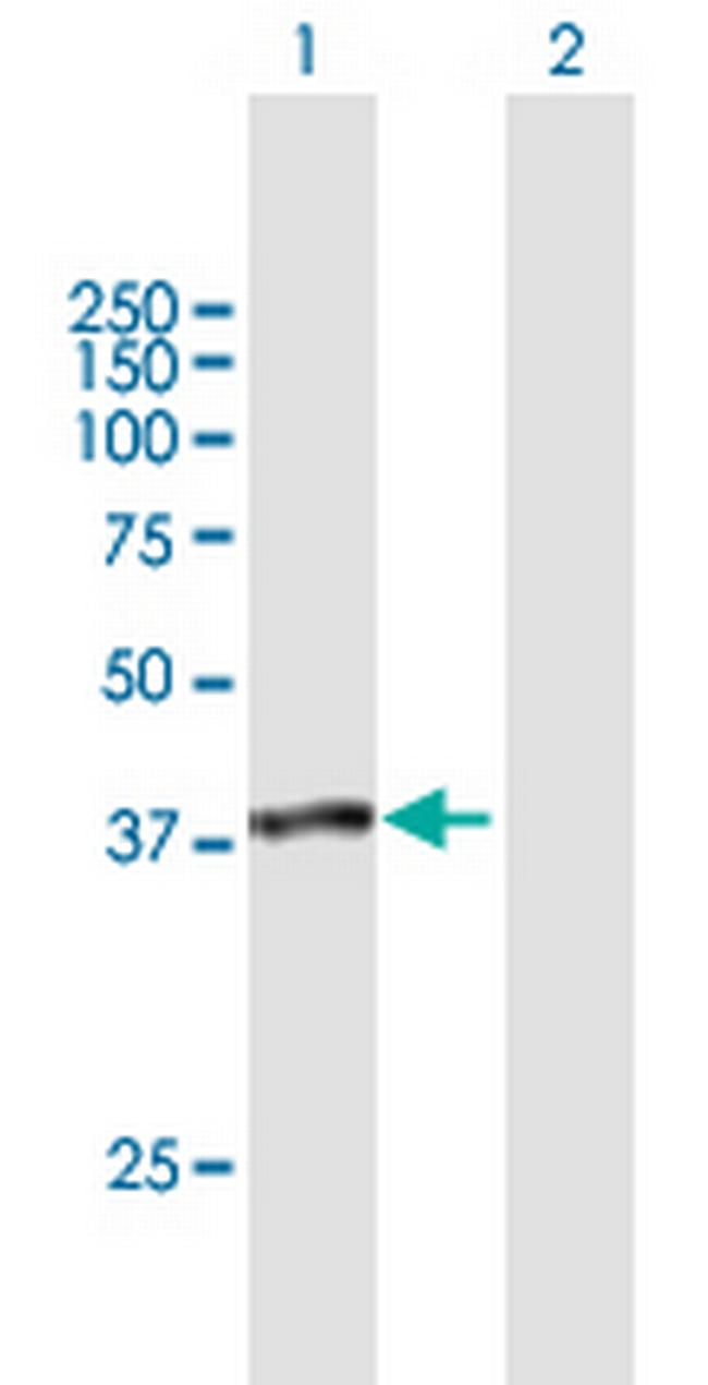 SUGT1 Antibody in Western Blot (WB)