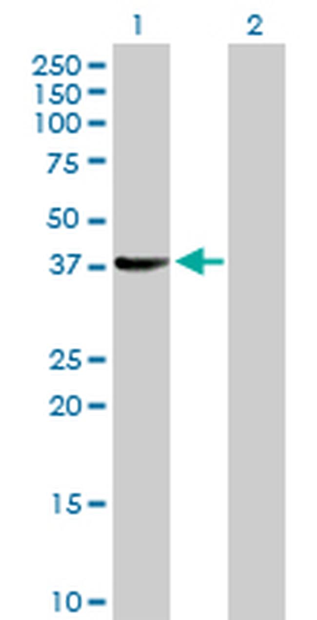 SUGT1 Antibody in Western Blot (WB)