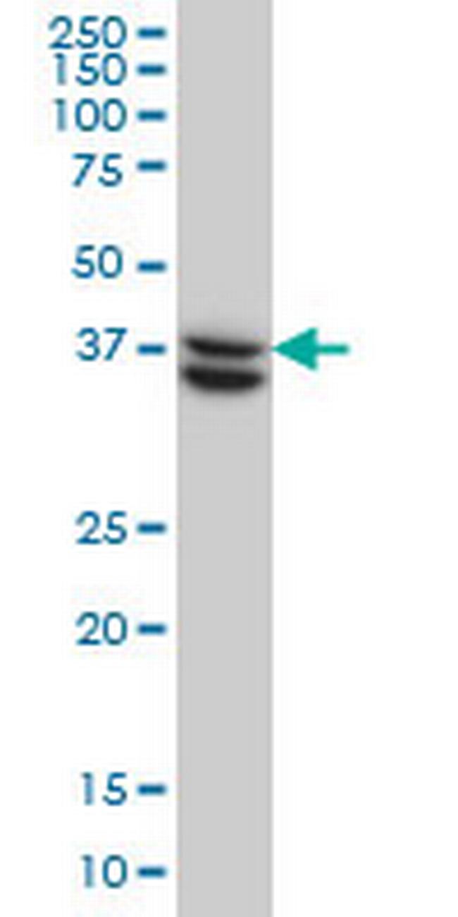 SUGT1 Antibody in Western Blot (WB)