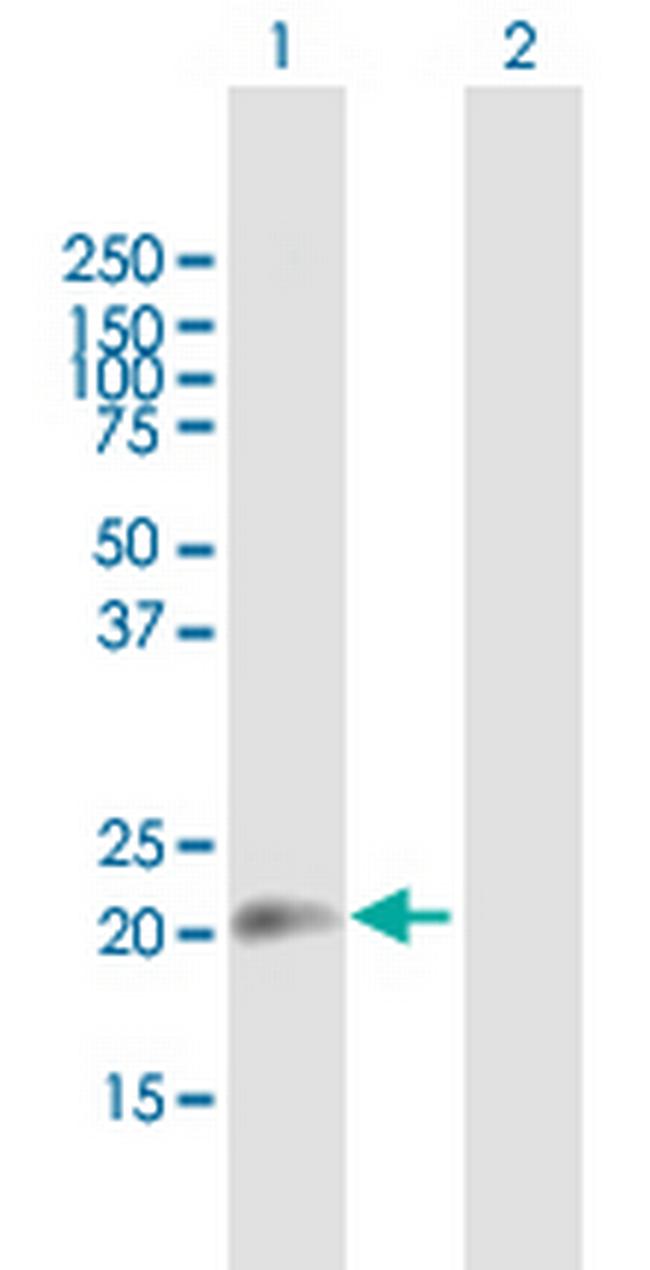 SUB1 Antibody in Western Blot (WB)