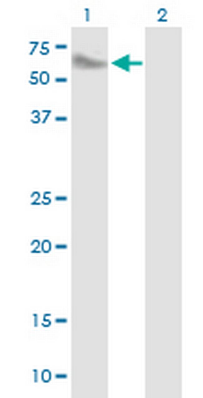 SMPDL3A Antibody in Western Blot (WB)