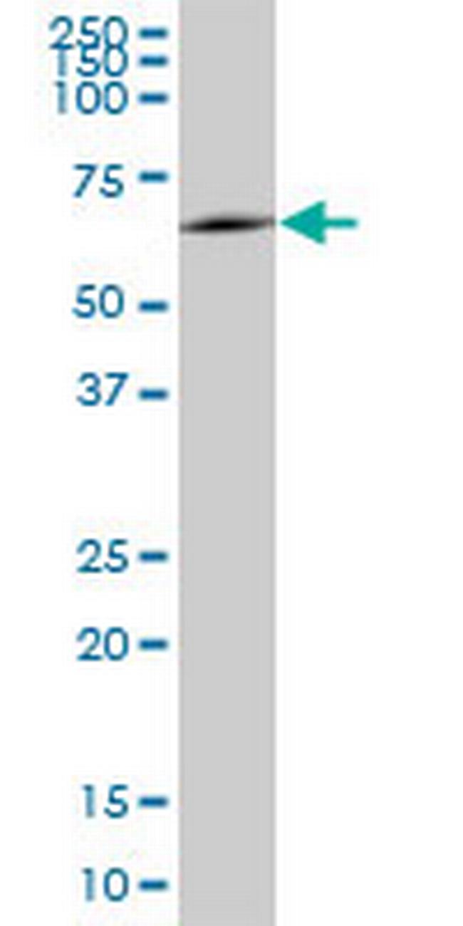 MSL3L1 Antibody in Western Blot (WB)