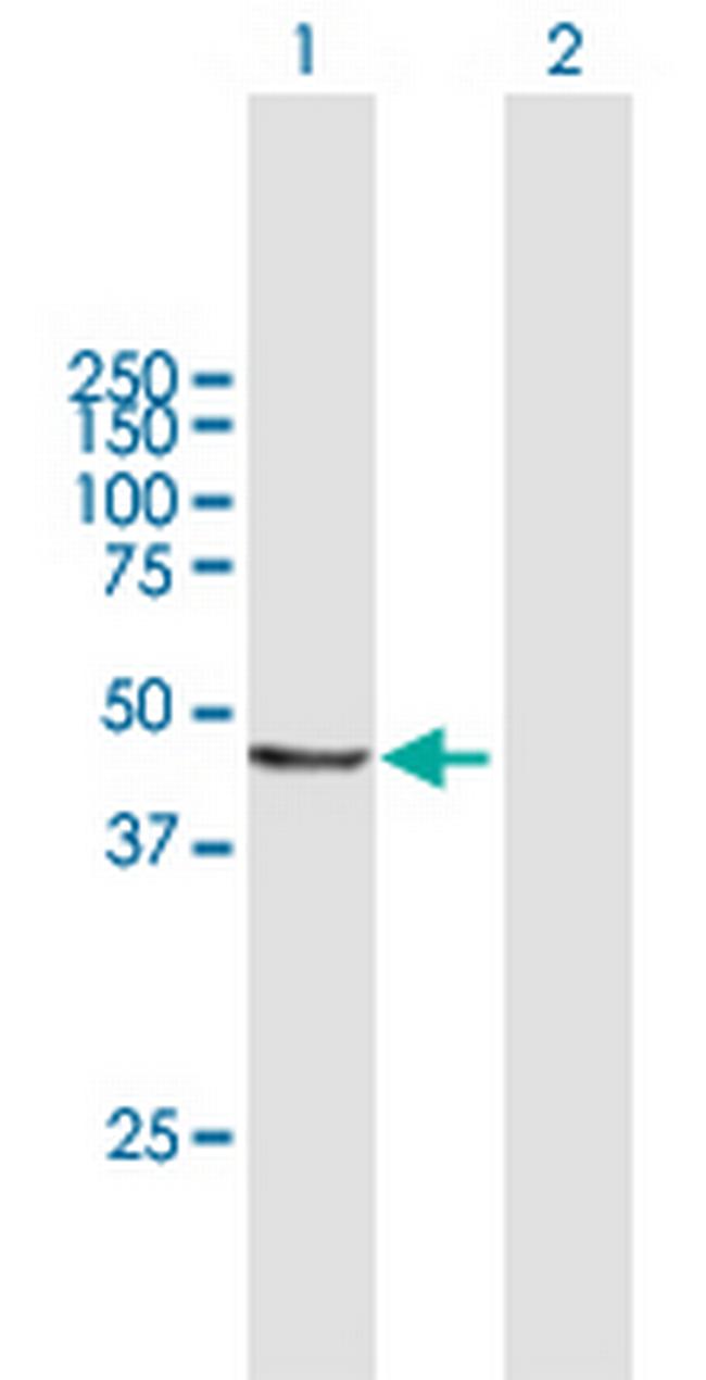 AP3M2 Antibody in Western Blot (WB)