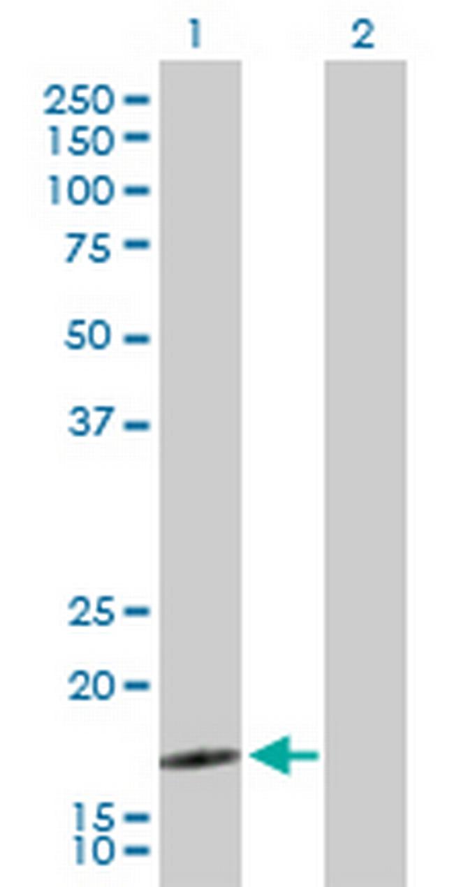SEC61B Antibody in Western Blot (WB)