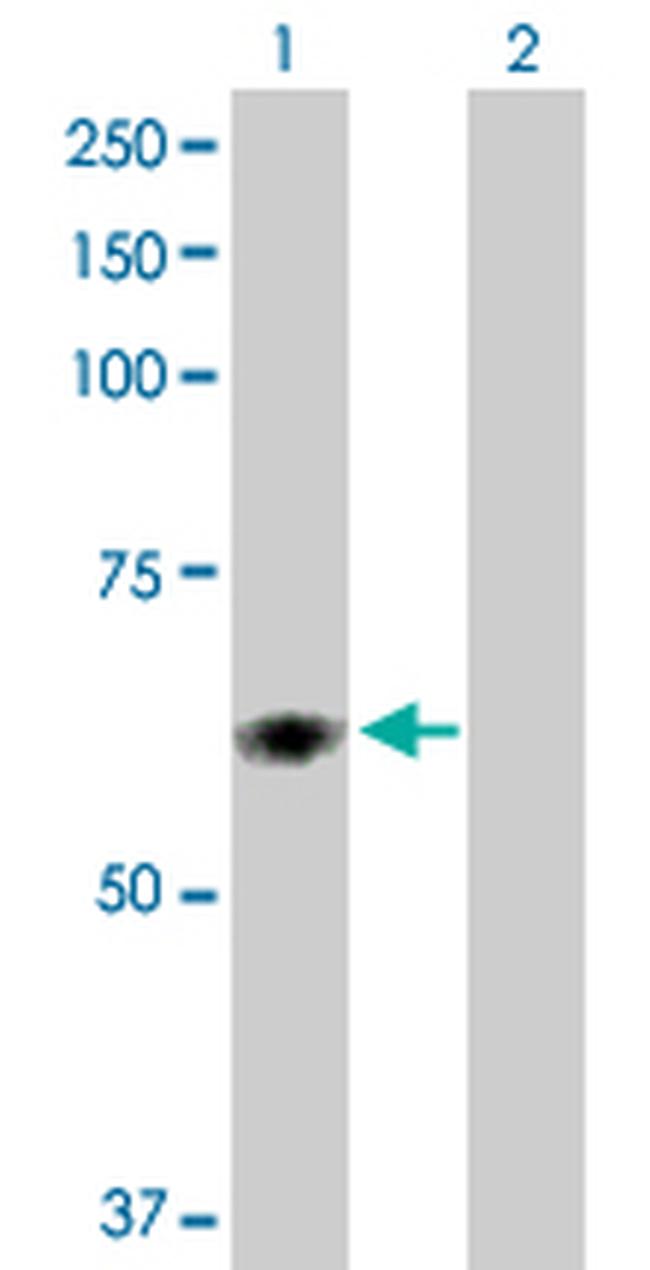 PDIA5 Antibody in Western Blot (WB)