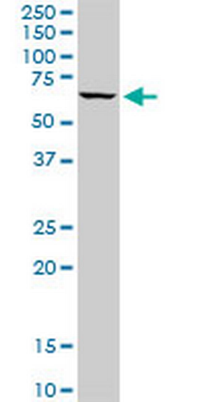 STIP1 Antibody in Western Blot (WB)