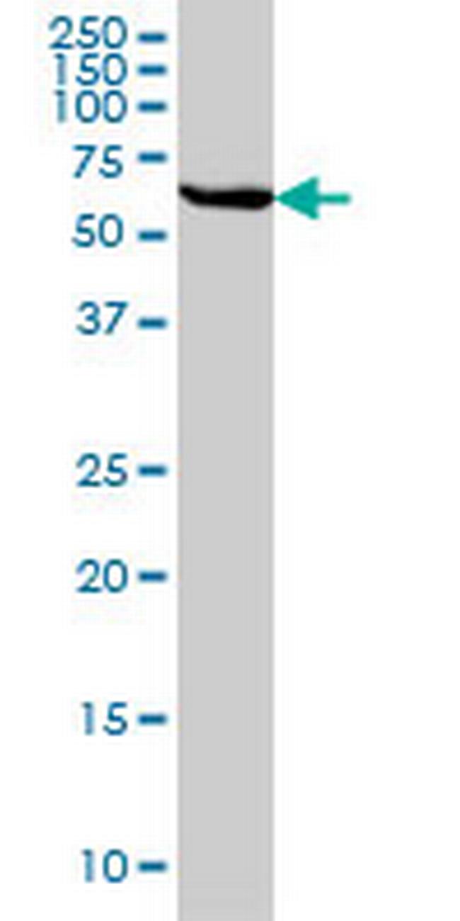 STIP1 Antibody in Western Blot (WB)