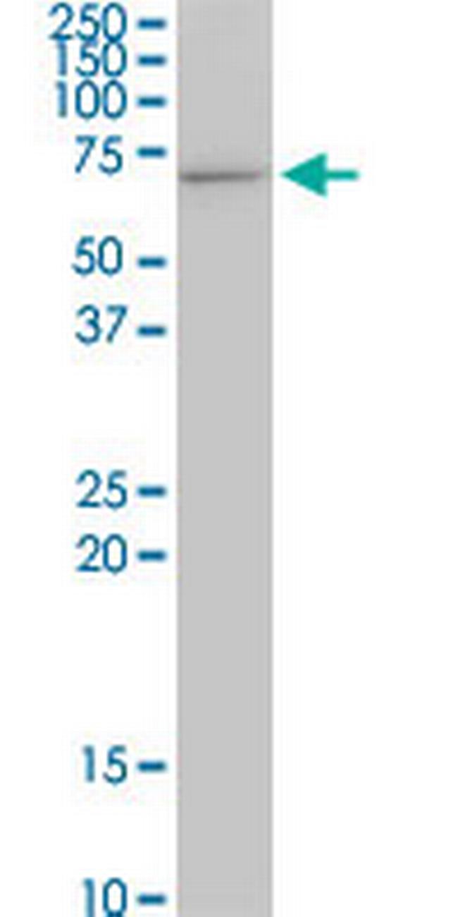 STIP1 Antibody in Western Blot (WB)
