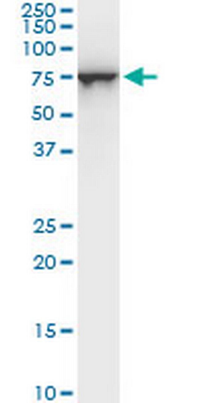 STIP1 Antibody in Western Blot (WB)