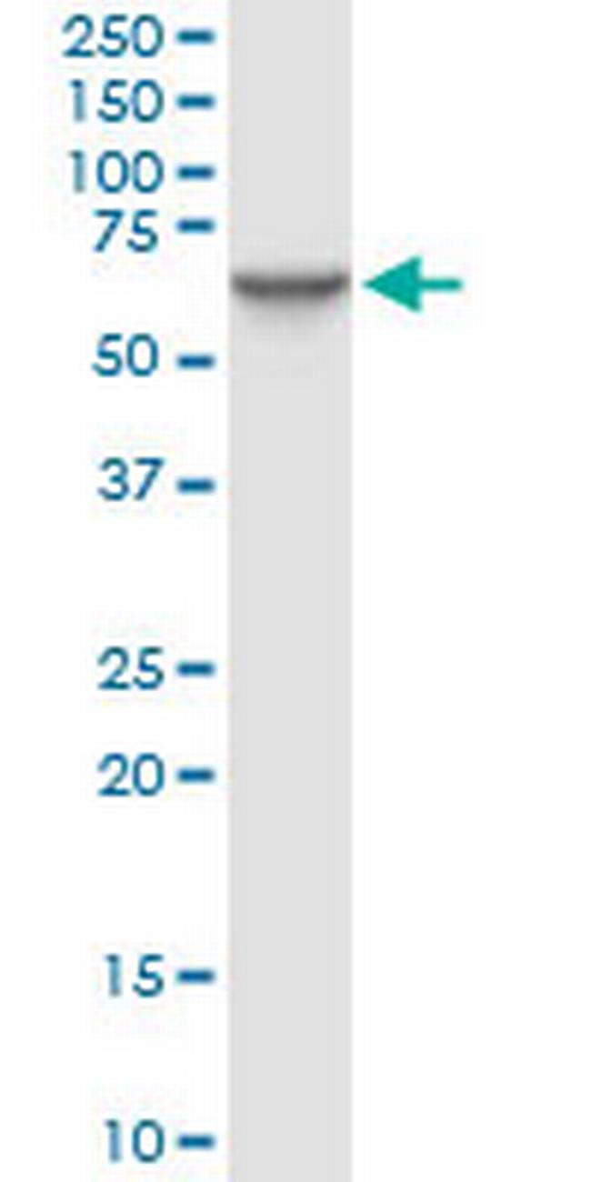 STIP1 Antibody in Western Blot (WB)