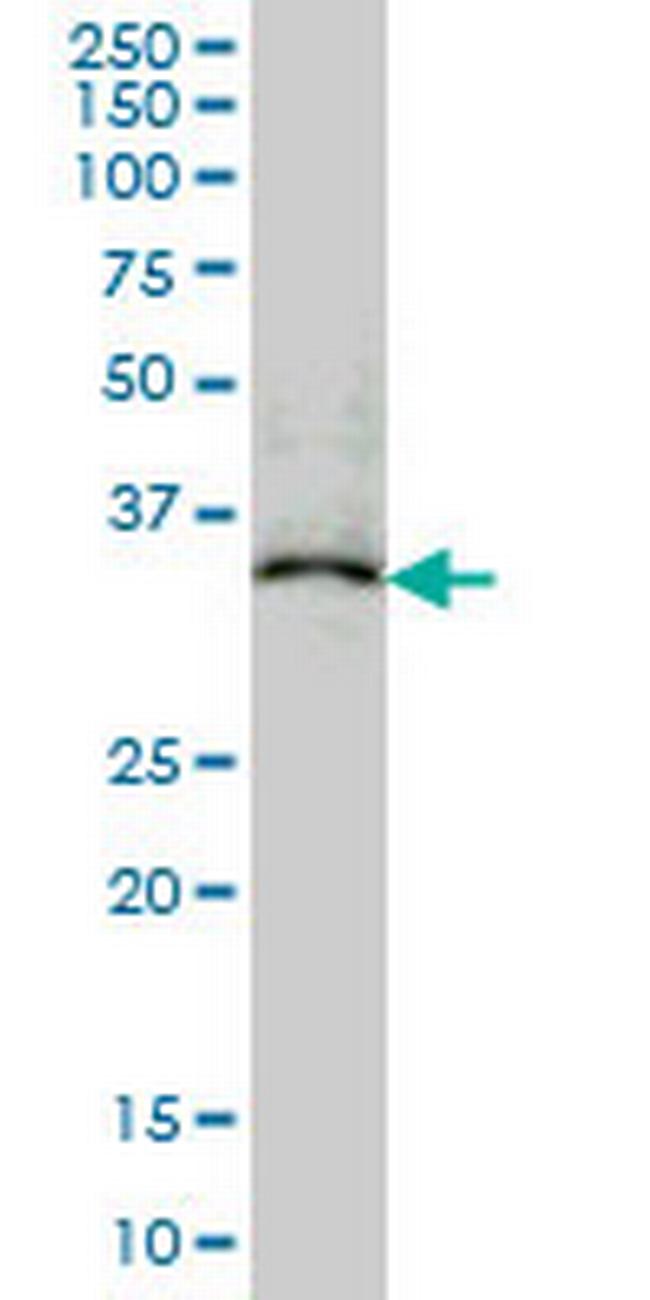 MAPRE2 Antibody in Western Blot (WB)