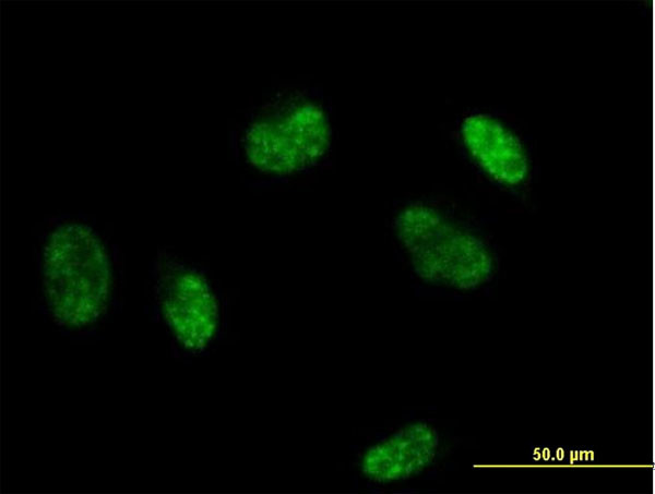 SF3B2 Antibody in Immunocytochemistry (ICC/IF)