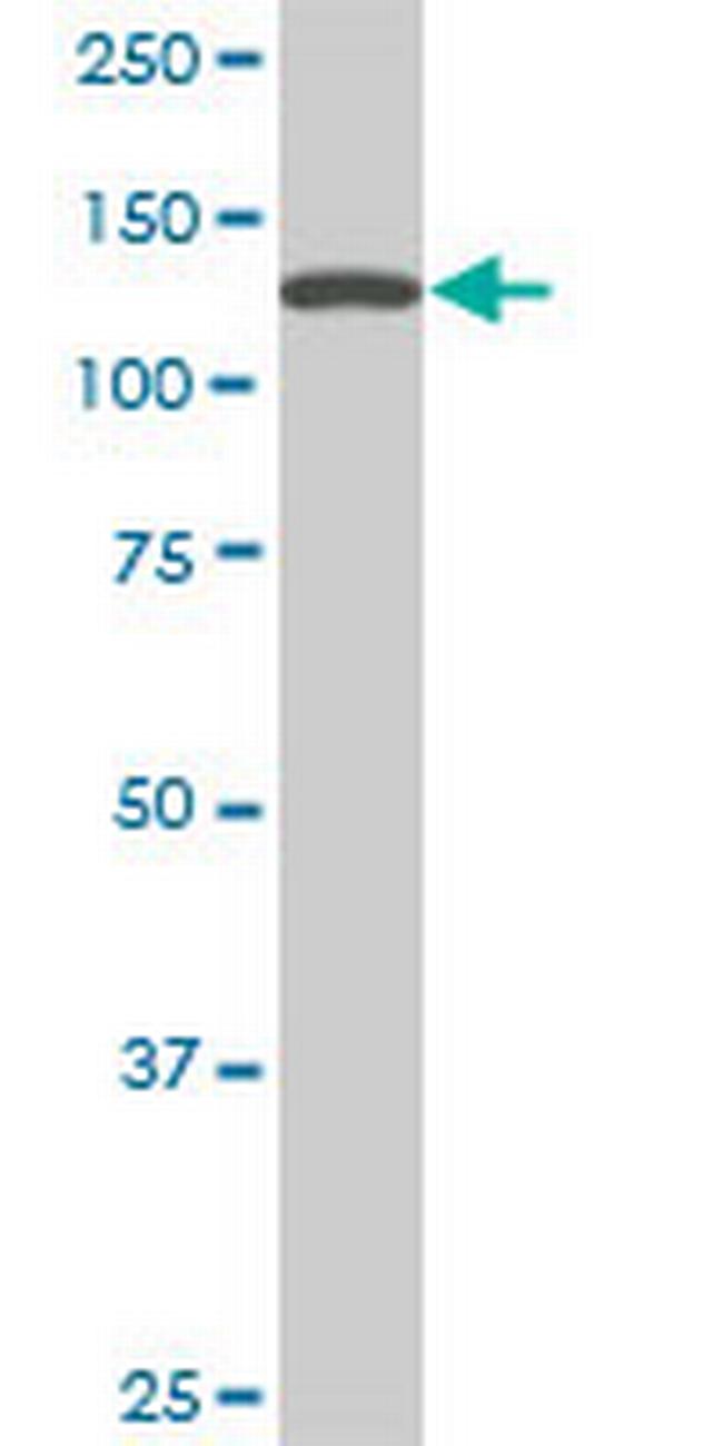 SF3B2 Antibody in Western Blot (WB)