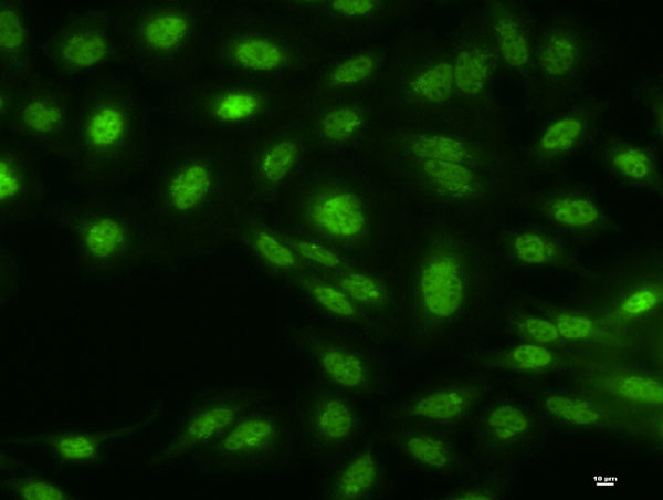 SF3B2 Antibody in Immunocytochemistry (ICC/IF)