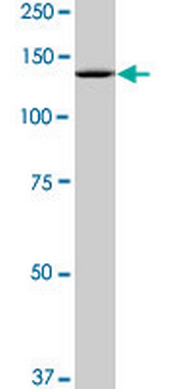 SF3B2 Antibody in Western Blot (WB)