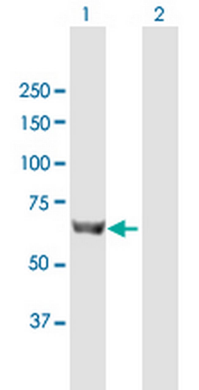 SLC27A5 Antibody in Western Blot (WB)
