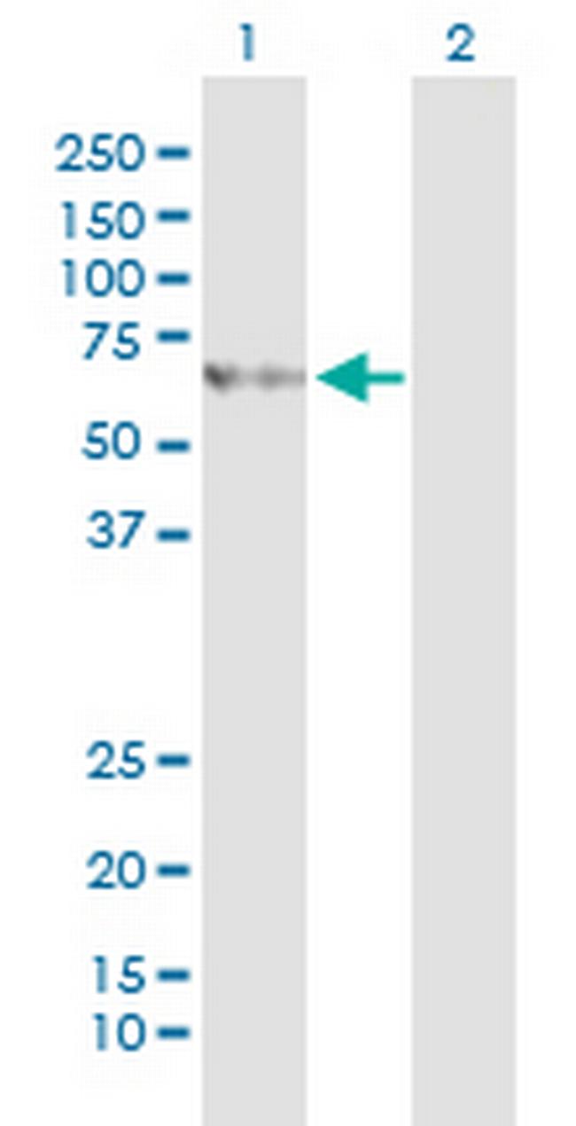 SLC27A5 Antibody in Western Blot (WB)