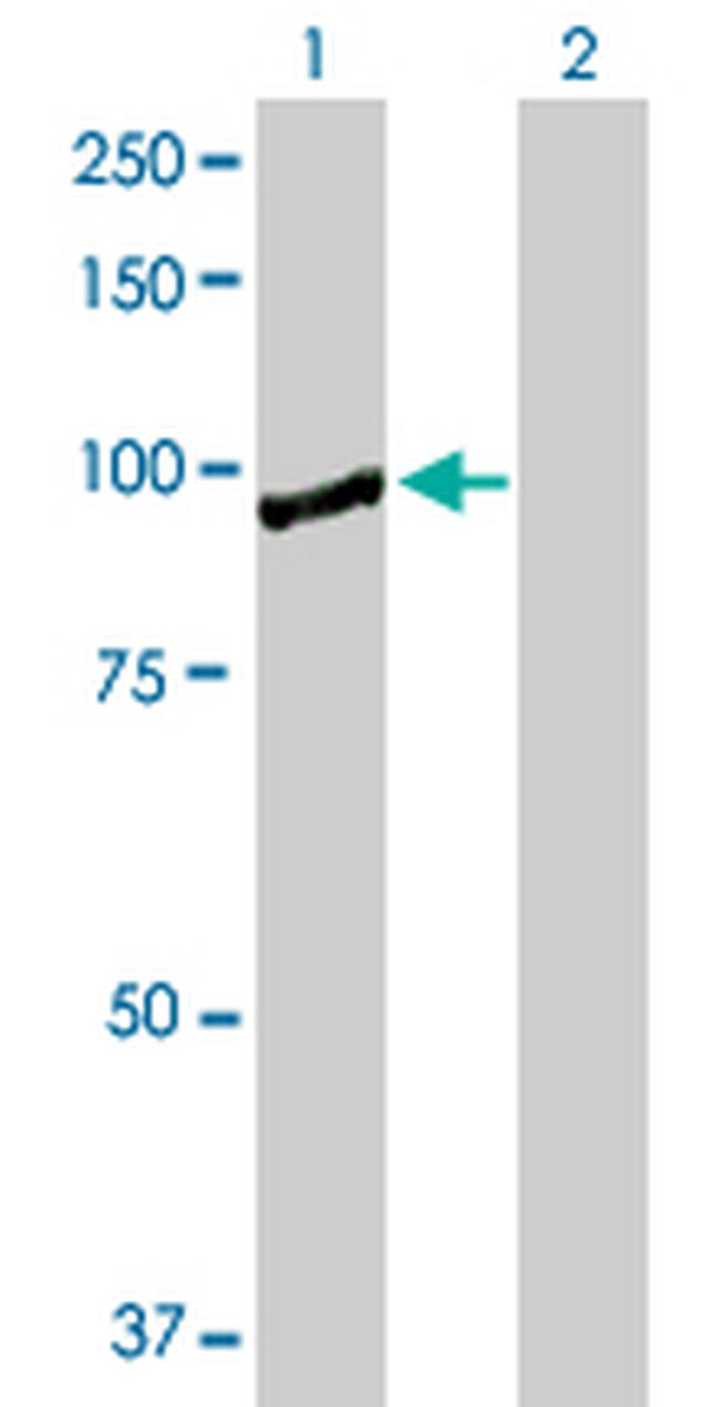 KIF2C Antibody in Western Blot (WB)