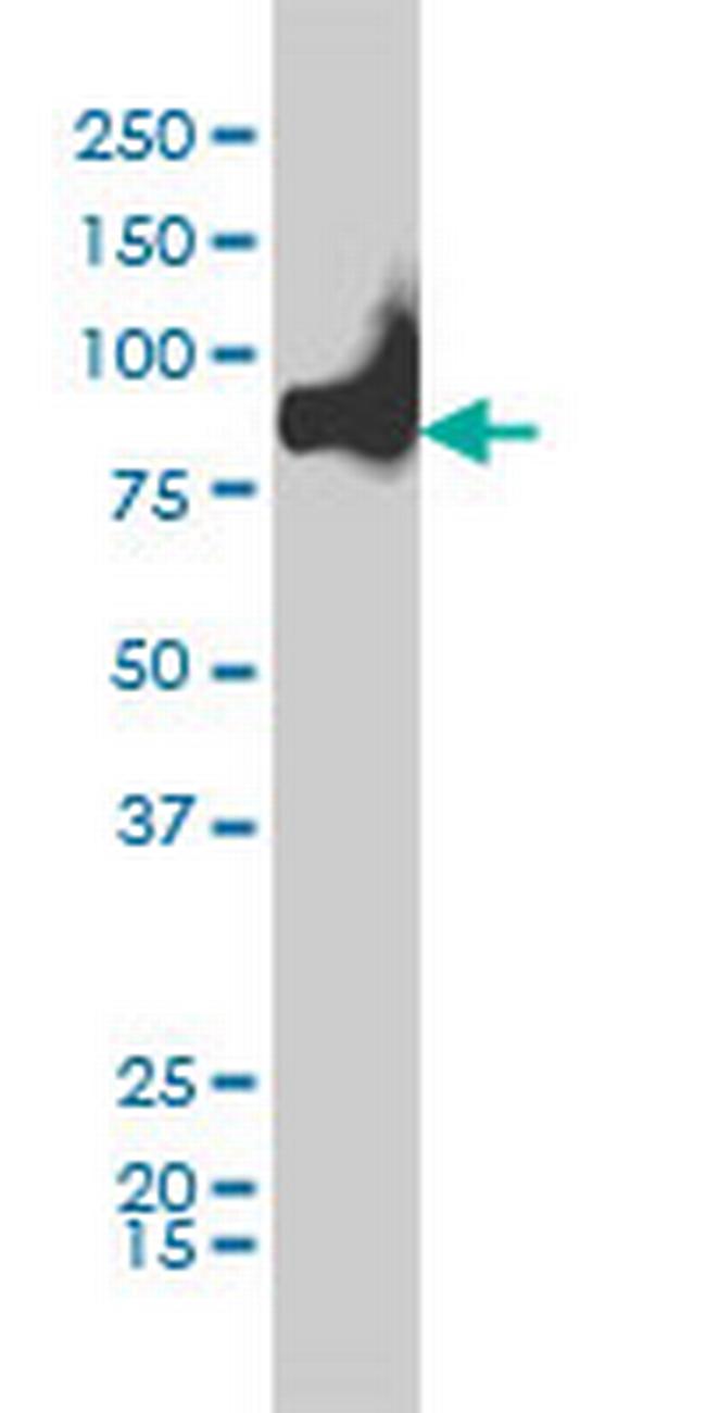 KIF2C Antibody in Western Blot (WB)