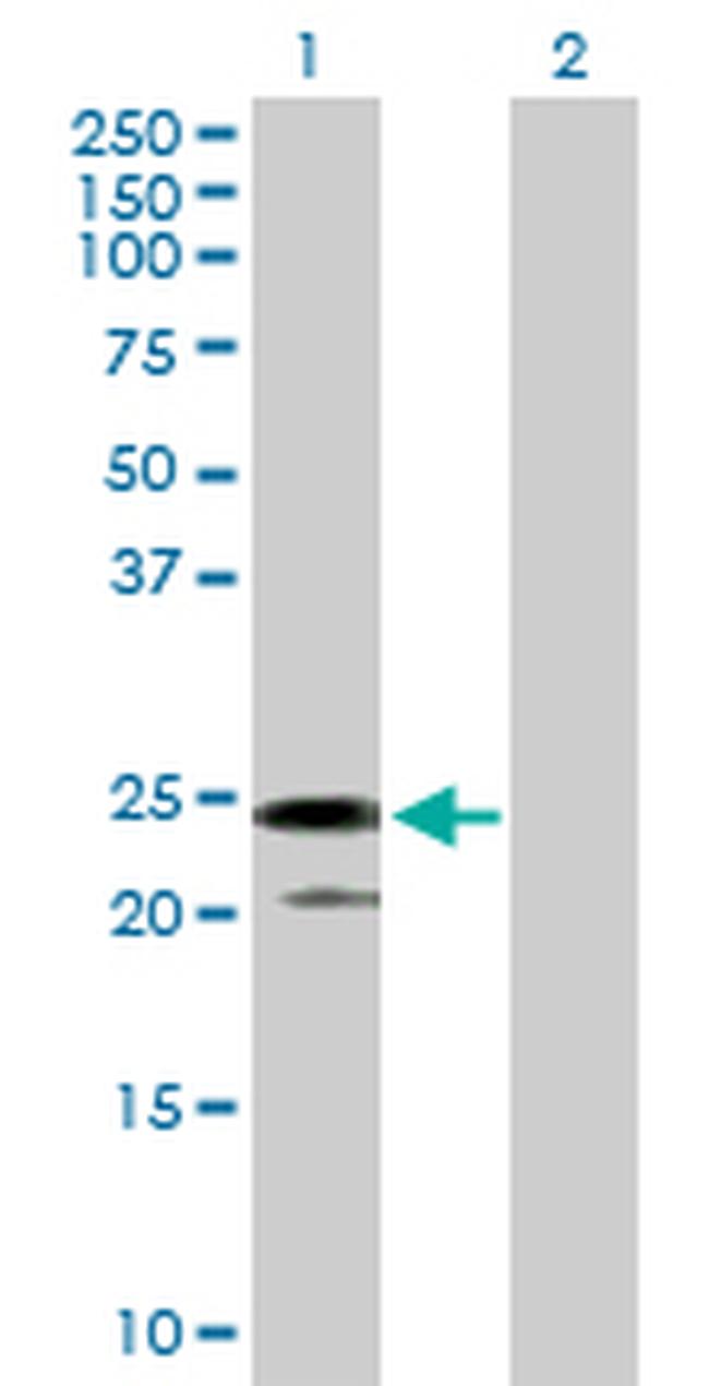 IL24 Antibody in Western Blot (WB)