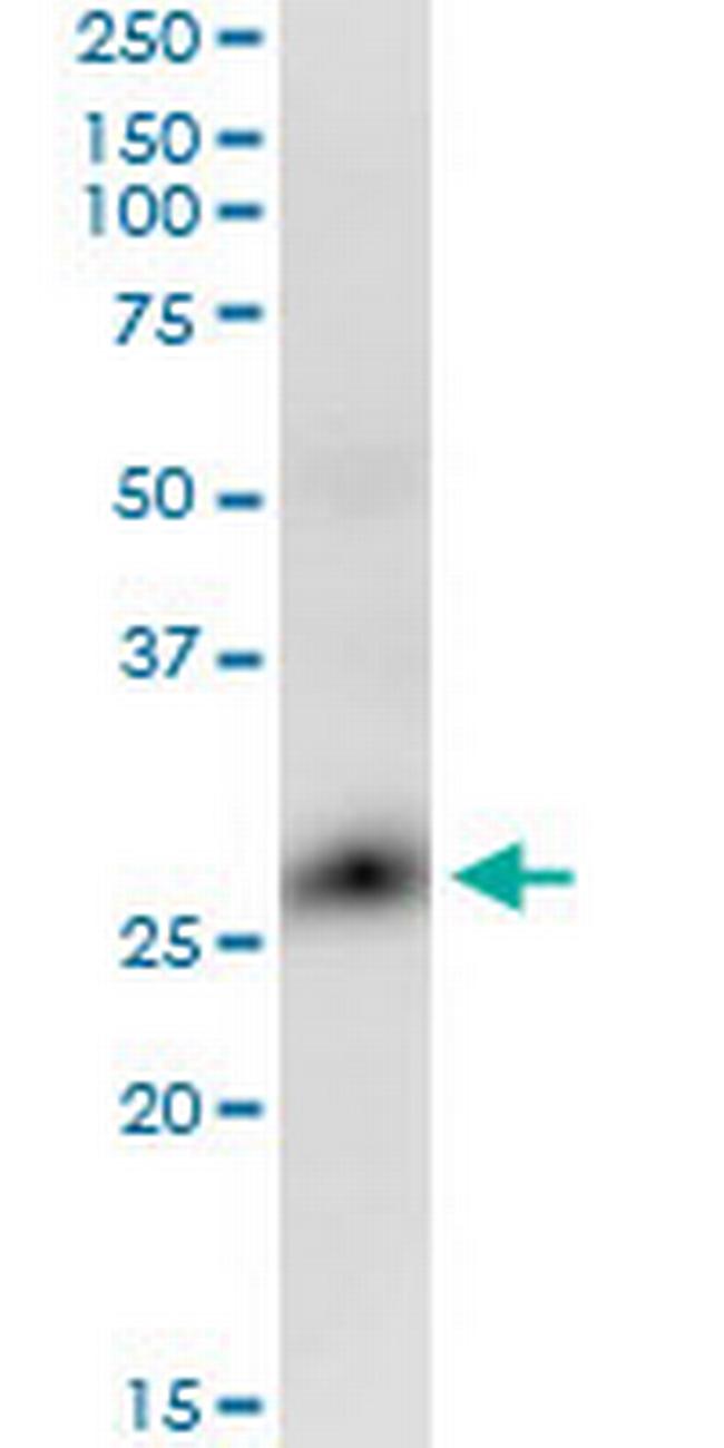 GLIPR1 Antibody in Western Blot (WB)