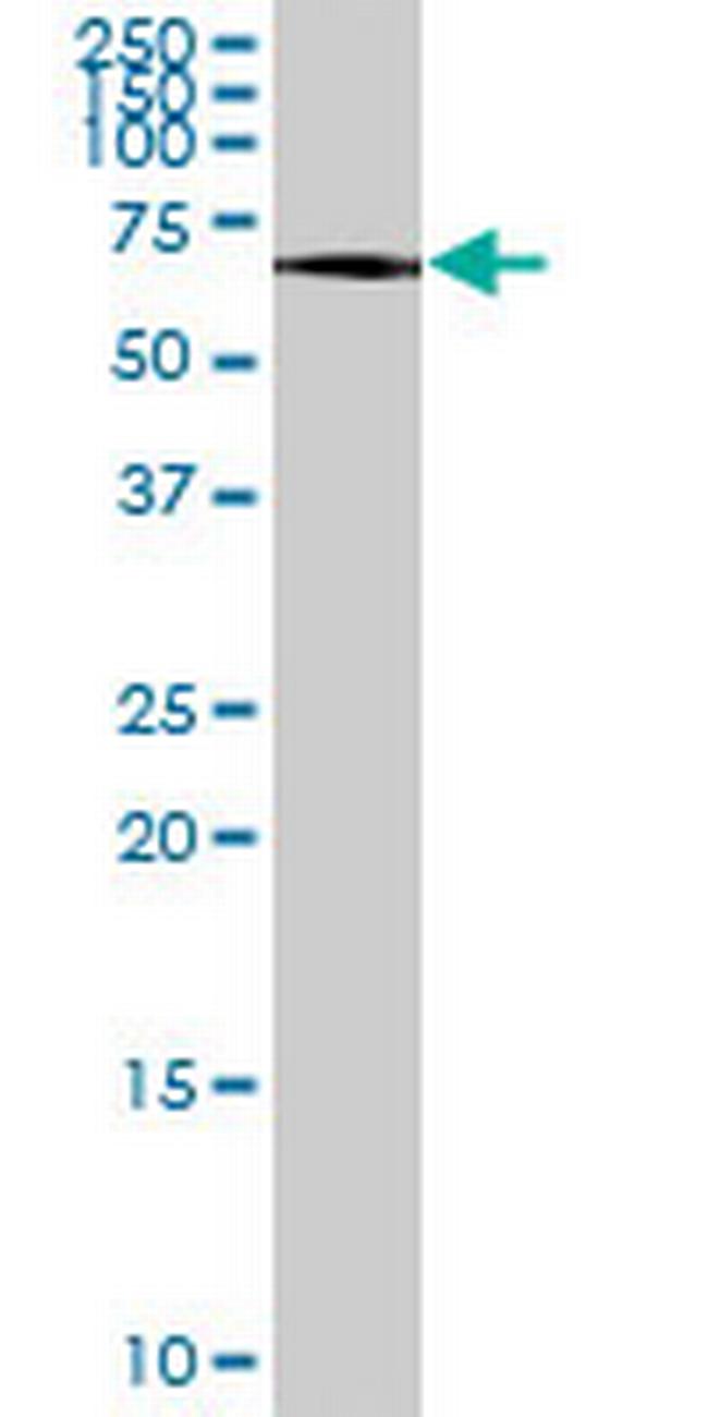 ATF7 Antibody in Western Blot (WB)