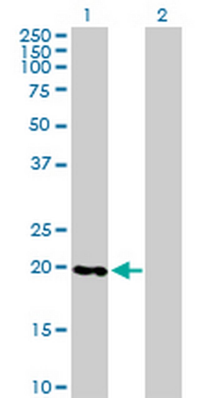 RABL4 Antibody in Western Blot (WB)