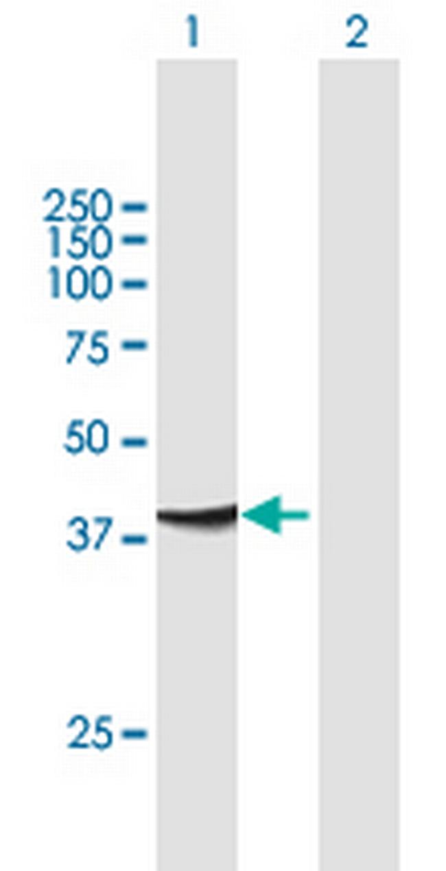 ADAP1 Antibody in Western Blot (WB)