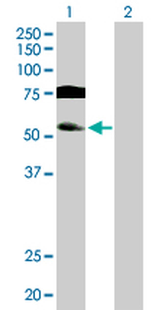 GTF2A1L Antibody in Western Blot (WB)