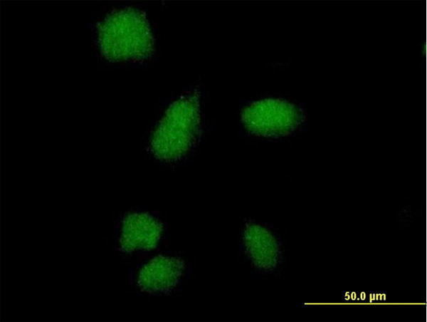 SMA4 Antibody in Immunocytochemistry (ICC/IF)