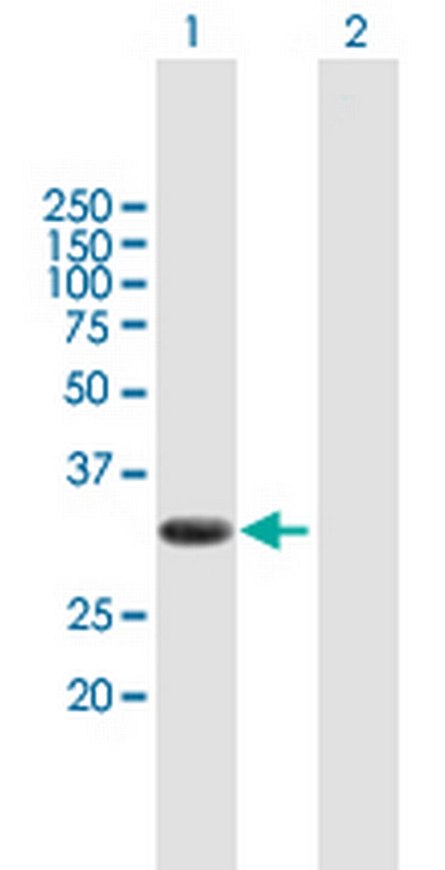 PIM2 Antibody in Western Blot (WB)