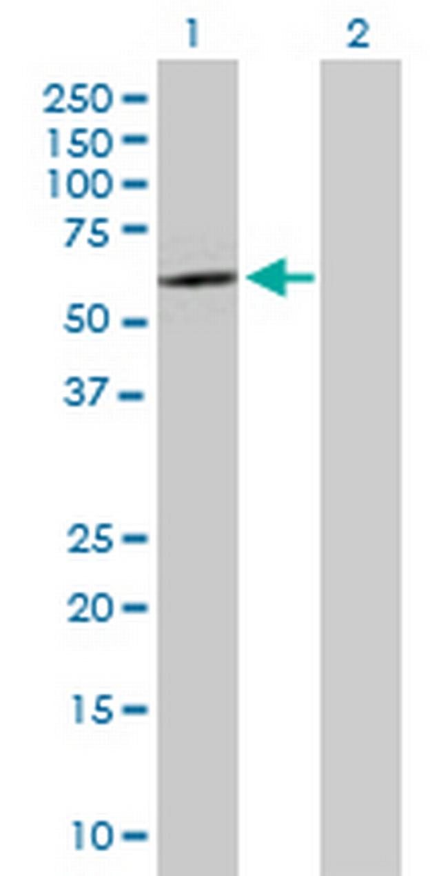 SOX30 Antibody in Western Blot (WB)