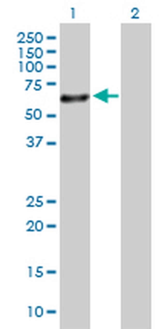SOX30 Antibody in Western Blot (WB)