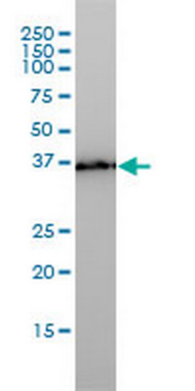 PL6 Antibody in Western Blot (WB)